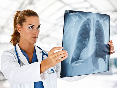 Eine Ärztin, die ein Röntgenbild der Lunge betrachtet.